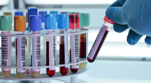 Pathology Lab Tests (Blood, Urine, Sputum etc. Tests) service image